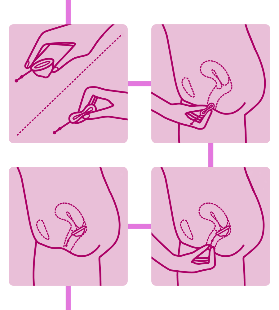 Passo a passo de como inserir seu disco menstrual Lumma corretamente